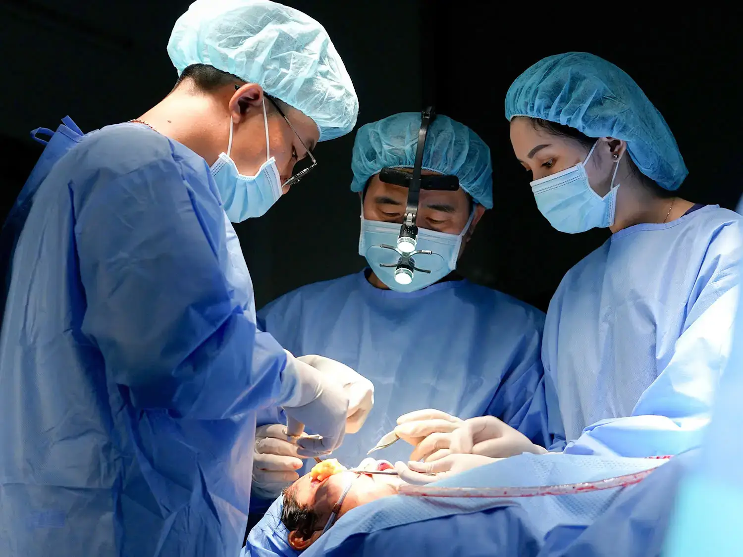 Kỹ thuật cấy mỡ nhiều lớp giúp bù đắp thể tích vùng lõm và hỗ trợ cân chỉnh hai bên khuôn mặt.